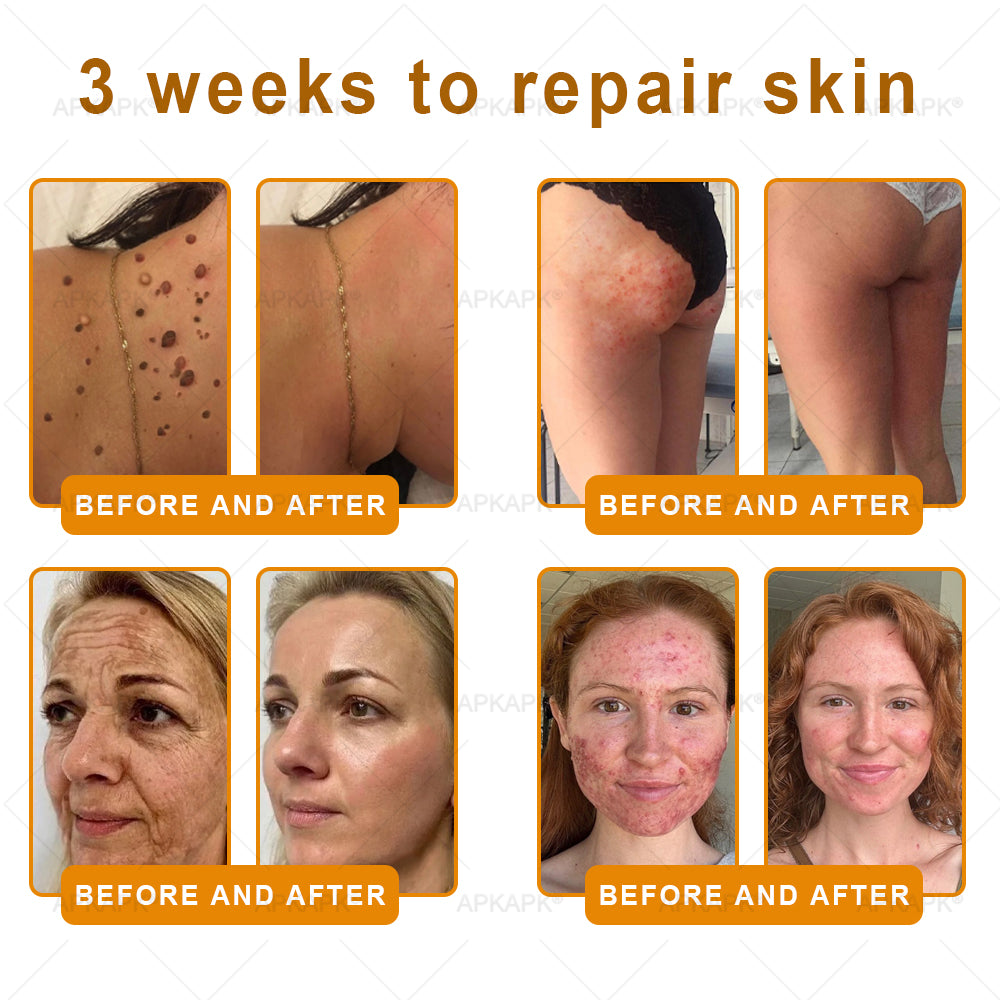 ✨✨ APKAPK® Bee venom Comprehensive Cream 🔥 Sagging Skin, Fine Lines, Loss of Firmness, Flat Bust, Drooping Hips, and More