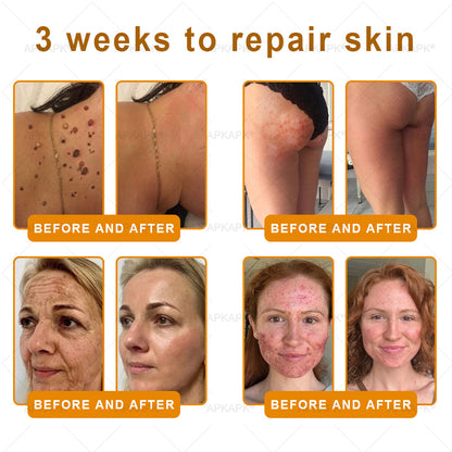 ✨✨ APKAPK® Bee venom Comprehensive Cream 🔥 Sagging Skin, Fine Lines, Loss of Firmness, Flat Bust, Drooping Hips, and More
