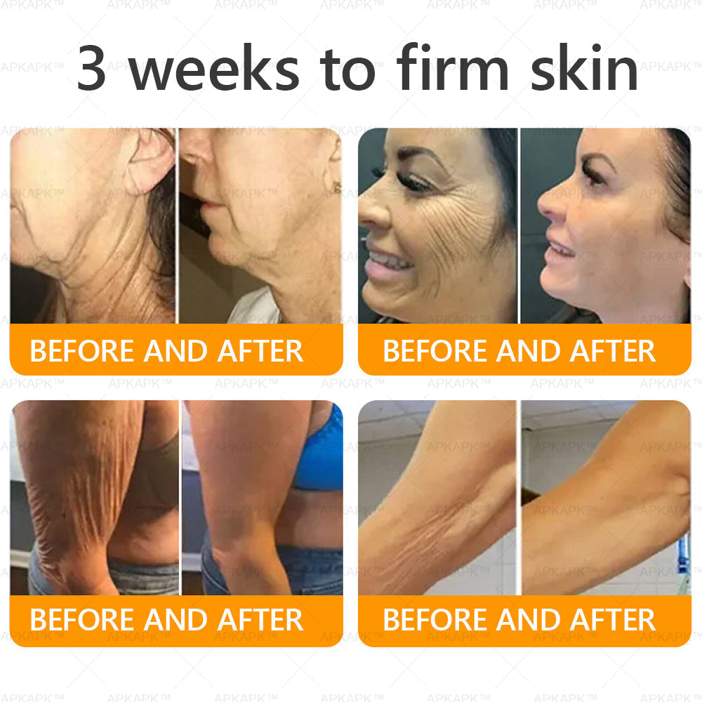 ✨✨ APKAPK® Bee venom Comprehensive Cream 🔥 Sagging Skin, Fine Lines, Loss of Firmness, Flat Bust, Drooping Hips, and More