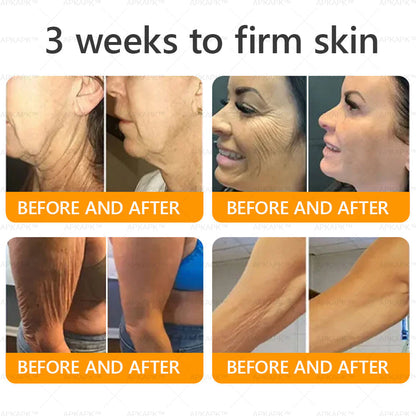 ✨✨ APKAPK® Bee venom Comprehensive Cream 🔥 Sagging Skin, Fine Lines, Loss of Firmness, Flat Bust, Drooping Hips, and More