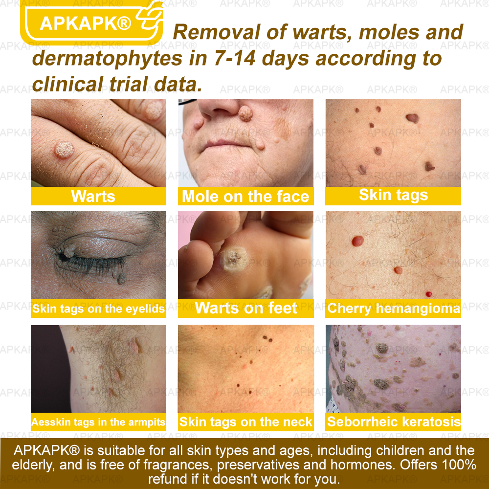 Instant Recovery🔥FDA Official: APKAPK® Bee Venom Skin Restoration Spray - Anti-aging, Hydrating, Skin Firming & Lifting, Skin Repair, Even Tone, Acne and Dark Spot Treatment, Wart and Mole Removal, and Psoriasis Relief.