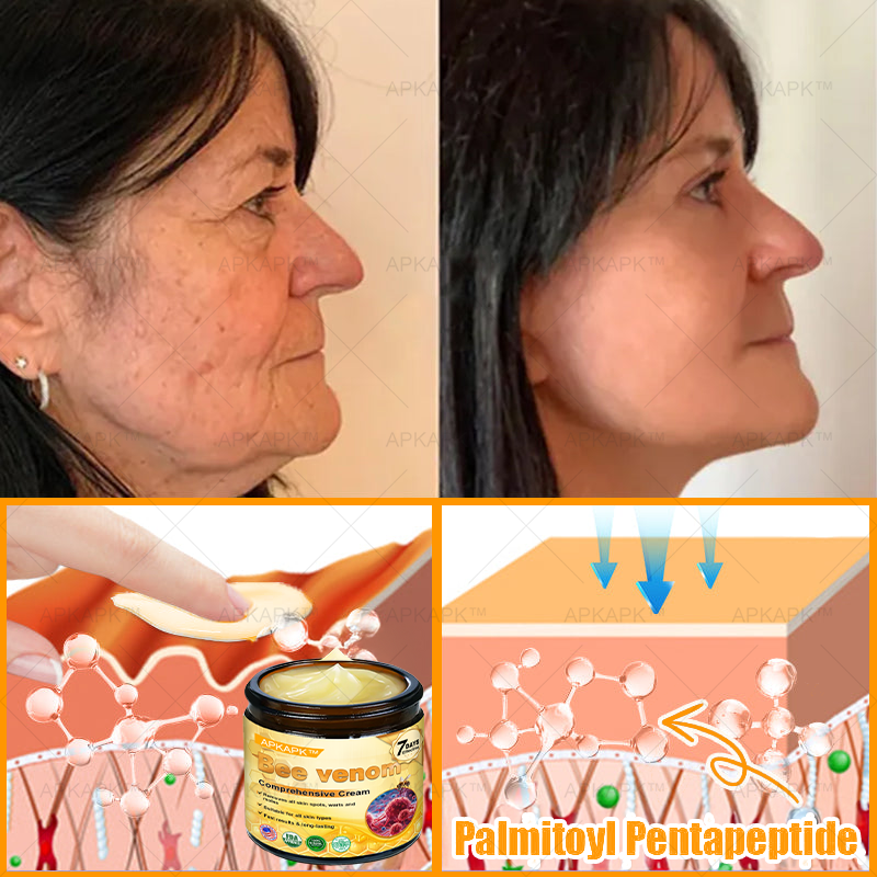 ✨✨ APKAPK® Bee venom Comprehensive Cream 🔥 Sagging Skin, Fine Lines, Loss of Firmness, Flat Bust, Drooping Hips, and More