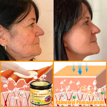 ✨✨ APKAPK® Bee venom Comprehensive Cream 🔥 Sagging Skin, Fine Lines, Loss of Firmness, Flat Bust, Drooping Hips, and More