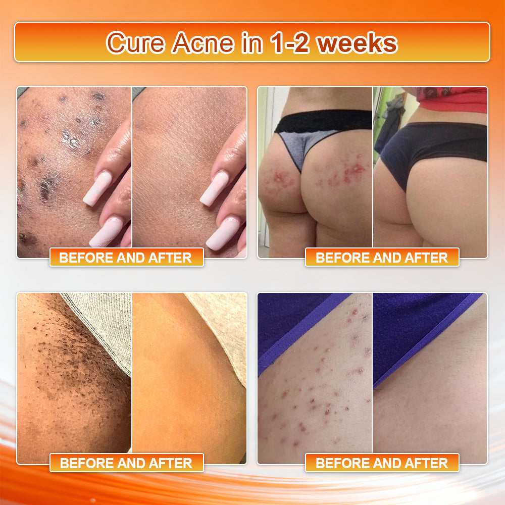 👙𝐎𝐟𝐟𝐢𝐜𝐢𝐚𝐥 𝐁𝐫𝐚𝐧𝐝 𝐒𝐭𝐨𝐫𝐞 | Von𝑢𝑡𝑟𝑖® 𝟐𝟎𝟐𝟔 𝐌𝐨𝐫𝐢𝐧𝐠𝐚 & 𝐁𝐞𝐫𝐛𝐞𝐫𝐢𝐧𝐞 𝟒-𝐈𝐧-𝟏 𝐌𝐢𝐜𝐫𝐨-𝐏𝐚𝐫𝐭𝐢𝐜𝐥𝐞 𝐒𝐜𝐮𝐥𝐩𝐭𝐢𝐧𝐠 & 𝐅𝐚𝐭-𝐁𝐮𝐫𝐧 𝐒𝐡𝐨𝐫𝐭𝐬