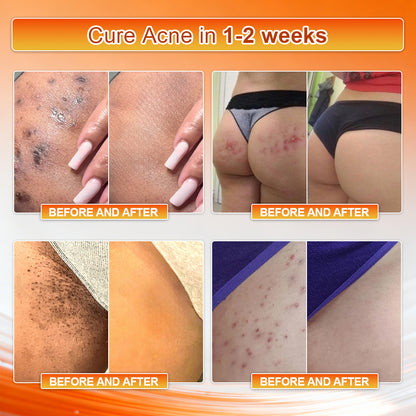 👙𝐎𝐟𝐟𝐢𝐜𝐢𝐚𝐥 𝐁𝐫𝐚𝐧𝐝 𝐒𝐭𝐨𝐫𝐞 | Von𝑢𝑡𝑟𝑖® 𝟐𝟎𝟐𝟔 𝐌𝐨𝐫𝐢𝐧𝐠𝐚 & 𝐁𝐞𝐫𝐛𝐞𝐫𝐢𝐧𝐞 𝟒-𝐈𝐧-𝟏 𝐌𝐢𝐜𝐫𝐨-𝐏𝐚𝐫𝐭𝐢𝐜𝐥𝐞 𝐒𝐜𝐮𝐥𝐩𝐭𝐢𝐧𝐠 & 𝐅𝐚𝐭-𝐁𝐮𝐫𝐧 𝐒𝐡𝐨𝐫𝐭𝐬