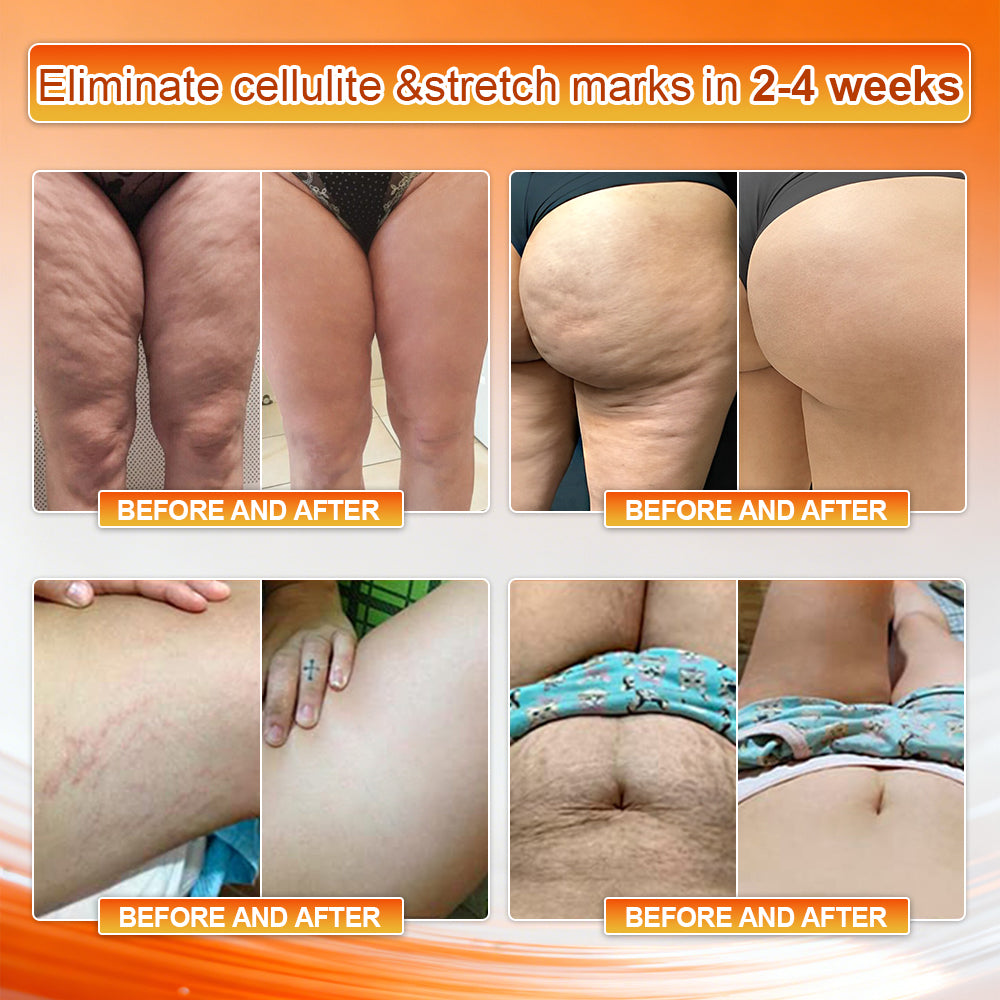 👙𝐎𝐟𝐟𝐢𝐜𝐢𝐚𝐥 𝐁𝐫𝐚𝐧𝐝 𝐒𝐭𝐨𝐫𝐞 | Von𝑢𝑡𝑟𝑖® 𝟐𝟎𝟐𝟔 𝐌𝐨𝐫𝐢𝐧𝐠𝐚 & 𝐁𝐞𝐫𝐛𝐞𝐫𝐢𝐧𝐞 𝟒-𝐈𝐧-𝟏 𝐌𝐢𝐜𝐫𝐨-𝐏𝐚𝐫𝐭𝐢𝐜𝐥𝐞 𝐒𝐜𝐮𝐥𝐩𝐭𝐢𝐧𝐠 & 𝐅𝐚𝐭-𝐁𝐮𝐫𝐧 𝐒𝐡𝐨𝐫𝐭𝐬