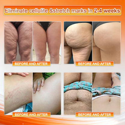 👙𝐎𝐟𝐟𝐢𝐜𝐢𝐚𝐥 𝐁𝐫𝐚𝐧𝐝 𝐒𝐭𝐨𝐫𝐞 | Von𝑢𝑡𝑟𝑖® 𝟐𝟎𝟐𝟔 𝐌𝐨𝐫𝐢𝐧𝐠𝐚 & 𝐁𝐞𝐫𝐛𝐞𝐫𝐢𝐧𝐞 𝟒-𝐈𝐧-𝟏 𝐌𝐢𝐜𝐫𝐨-𝐏𝐚𝐫𝐭𝐢𝐜𝐥𝐞 𝐒𝐜𝐮𝐥𝐩𝐭𝐢𝐧𝐠 & 𝐅𝐚𝐭-𝐁𝐮𝐫𝐧 𝐒𝐡𝐨𝐫𝐭𝐬