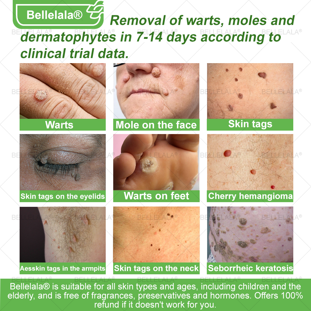 💎🇺🇸 Made & Shipped in the USA | Clinically Proven: Bellelala® Bee Venom Multi-Care Repair Cream with Melittin, salicylic acid, niacinamide, and hyaluronic acid, Vitamin C💧 Targets signs of aging, acne, scars, warts, psoriasis, dark spots, eczema and more.