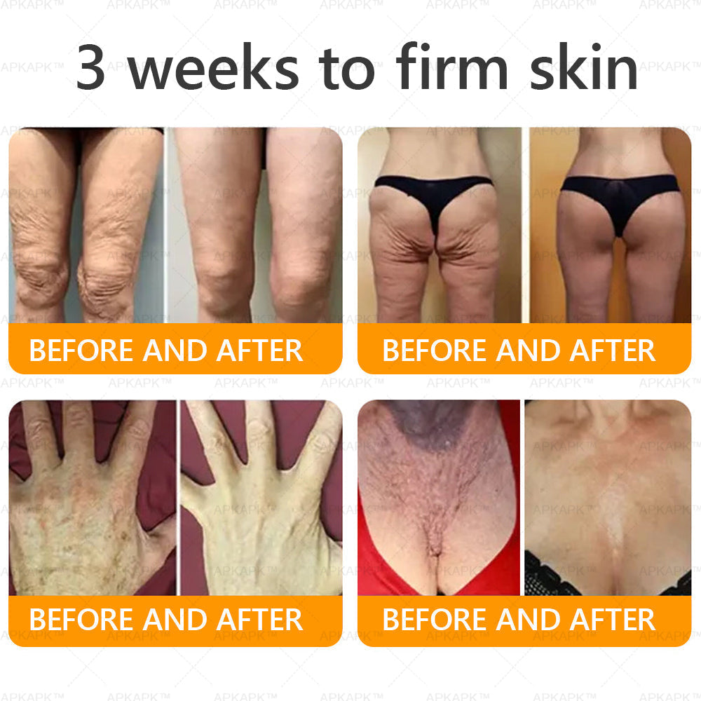 ✨✨ APKAPK® Bee venom Comprehensive Cream 🔥 Sagging Skin, Fine Lines, Loss of Firmness, Flat Bust, Drooping Hips, and More