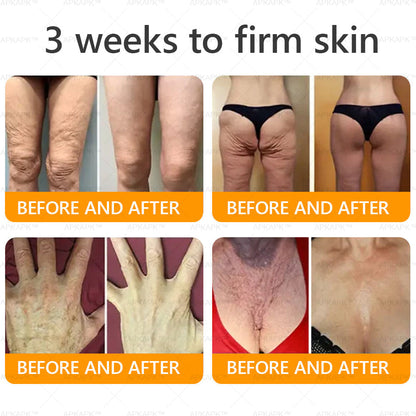 ✨✨ APKAPK® Bee venom Comprehensive Cream 🔥 Sagging Skin, Fine Lines, Loss of Firmness, Flat Bust, Drooping Hips, and More