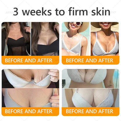 ✨✨ APKAPK® Bee venom Comprehensive Cream 🔥 Sagging Skin, Fine Lines, Loss of Firmness, Flat Bust, Drooping Hips, and More