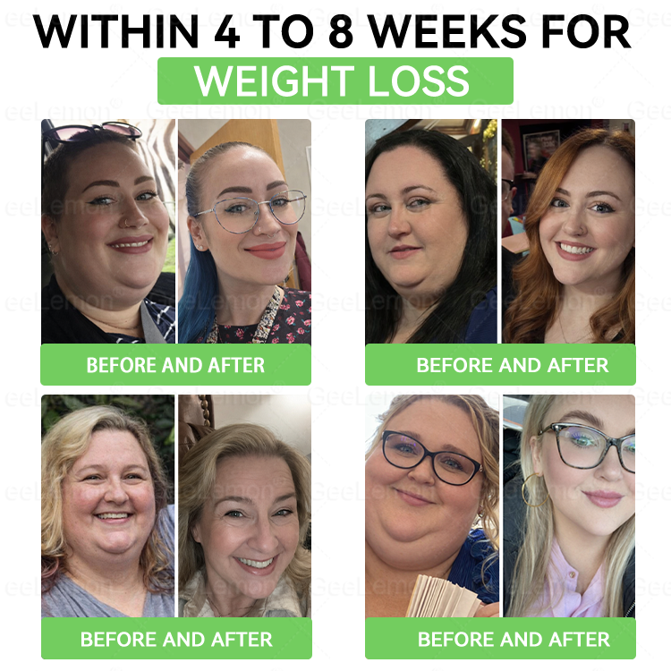 💥Buy 5, Get 5 FREE | 𝐆𝐞𝐞𝐋𝐞𝐦𝐨𝐧® 𝐍𝑴𝑵 × 𝐌𝐨𝐫𝐢𝐧𝐠𝐚 · 𝑨𝑴𝑷𝑲 𝟏𝟎-𝐢𝐧-𝟏 𝐀𝐝𝐯𝐚𝐧𝐜𝐞𝐝 𝐍𝐚𝐧𝐨 𝐌𝐢𝐜𝐫𝐨𝐧𝐞𝐞𝐝𝐥𝐞 𝐏𝐚𝐭𝐜𝐡 — 🇺🇸(𝐉𝐮𝐬𝐭 𝐨𝐧𝐜𝐞 𝐚 𝐝𝐚𝐲, 𝐯𝐢𝐬𝐢𝐛𝐥𝐞 𝐜𝐡𝐚𝐧𝐠𝐞𝐬 𝐢𝐧 𝟕 𝐝𝐚𝐲𝐬）𝘽𝙚𝙧𝙗𝙚𝙧𝙞𝙣𝙚 + 𝙈𝙤𝙧𝙞𝙣𝙜𝙖 𝙁𝙤𝙧𝙢𝙪𝙡𝙖 ✅ 𝐅𝐨𝐫 𝐨𝐛𝐞𝐬𝐢𝐭𝐲, 𝗟𝗼𝗼𝘀𝗲 𝘀𝗸𝗶𝗻,𝐝𝐢𝐚𝐛𝐞𝐭𝐞𝐬, 𝐬𝐥𝐞𝐞𝐩 𝐚𝐩𝐧𝐞𝐚, 𝐣𝐨𝐢𝐧𝐭 𝐢𝐬𝐬𝐮𝐞𝐬, 𝐚𝐧𝐝 𝐦𝐨𝐫𝐞 💥