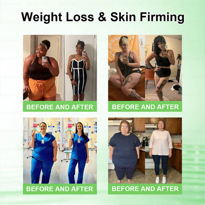 💥Buy 5, Get 5 FREE | 𝐆𝐞𝐞𝐋𝐞𝐦𝐨𝐧® 𝐍𝑴𝑵 × 𝐌𝐨𝐫𝐢𝐧𝐠𝐚 · 𝑨𝑴𝑷𝑲 𝟏𝟎-𝐢𝐧-𝟏 𝐀𝐝𝐯𝐚𝐧𝐜𝐞𝐝 𝐍𝐚𝐧𝐨 𝐌𝐢𝐜𝐫𝐨𝐧𝐞𝐞𝐝𝐥𝐞 𝐏𝐚𝐭𝐜𝐡 — 🇺🇸(𝐉𝐮𝐬𝐭 𝐨𝐧𝐜𝐞 𝐚 𝐝𝐚𝐲, 𝐯𝐢𝐬𝐢𝐛𝐥𝐞 𝐜𝐡𝐚𝐧𝐠𝐞𝐬 𝐢𝐧 𝟕 𝐝𝐚𝐲𝐬）𝘽𝙚𝙧𝙗𝙚𝙧𝙞𝙣𝙚 + 𝙈𝙤𝙧𝙞𝙣𝙜𝙖 𝙁𝙤𝙧𝙢𝙪𝙡𝙖 ✅ 𝐅𝐨𝐫 𝐨𝐛𝐞𝐬𝐢𝐭𝐲, 𝗟𝗼𝗼𝘀𝗲 𝘀𝗸𝗶𝗻,𝐝𝐢𝐚𝐛𝐞𝐭𝐞𝐬, 𝐬𝐥𝐞𝐞𝐩 𝐚𝐩𝐧𝐞𝐚, 𝐣𝐨𝐢𝐧𝐭 𝐢𝐬𝐬𝐮𝐞𝐬, 𝐚𝐧𝐝 𝐦𝐨𝐫𝐞 💥