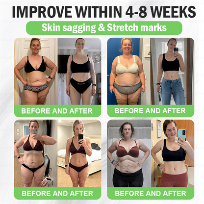 💥Buy 5, Get 5 FREE | 𝐆𝐞𝐞𝐋𝐞𝐦𝐨𝐧® 𝐍𝑴𝑵 × 𝐌𝐨𝐫𝐢𝐧𝐠𝐚 · 𝑨𝑴𝑷𝑲 𝟏𝟎-𝐢𝐧-𝟏 𝐀𝐝𝐯𝐚𝐧𝐜𝐞𝐝 𝐍𝐚𝐧𝐨 𝐌𝐢𝐜𝐫𝐨𝐧𝐞𝐞𝐝𝐥𝐞 𝐏𝐚𝐭𝐜𝐡 — 🇺🇸(𝐉𝐮𝐬𝐭 𝐨𝐧𝐜𝐞 𝐚 𝐝𝐚𝐲, 𝐯𝐢𝐬𝐢𝐛𝐥𝐞 𝐜𝐡𝐚𝐧𝐠𝐞𝐬 𝐢𝐧 𝟕 𝐝𝐚𝐲𝐬）𝘽𝙚𝙧𝙗𝙚𝙧𝙞𝙣𝙚 + 𝙈𝙤𝙧𝙞𝙣𝙜𝙖 𝙁𝙤𝙧𝙢𝙪𝙡𝙖 ✅ 𝐅𝐨𝐫 𝐨𝐛𝐞𝐬𝐢𝐭𝐲, 𝗟𝗼𝗼𝘀𝗲 𝘀𝗸𝗶𝗻,𝐝𝐢𝐚𝐛𝐞𝐭𝐞𝐬, 𝐬𝐥𝐞𝐞𝐩 𝐚𝐩𝐧𝐞𝐚, 𝐣𝐨𝐢𝐧𝐭 𝐢𝐬𝐬𝐮𝐞𝐬, 𝐚𝐧𝐝 𝐦𝐨𝐫𝐞 💥